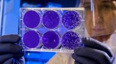 Scientist examines the result of a plaque assay.