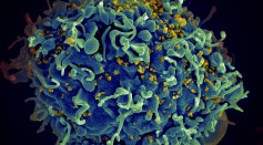  HIV-Infected Cells Susceptible Specific Targeted Therapies, New Insights Reveal
