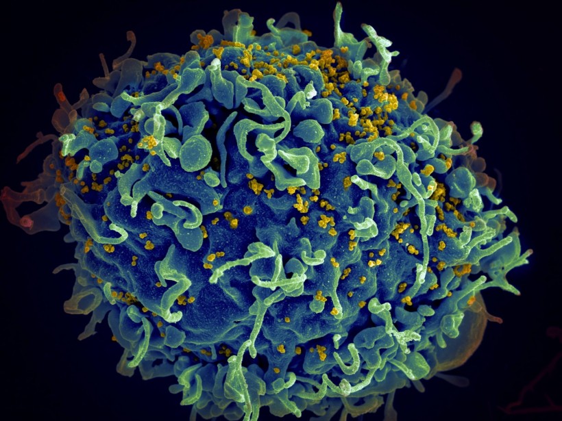  HIV-Infected Cells Susceptible Specific Targeted Therapies, New Insights Reveal