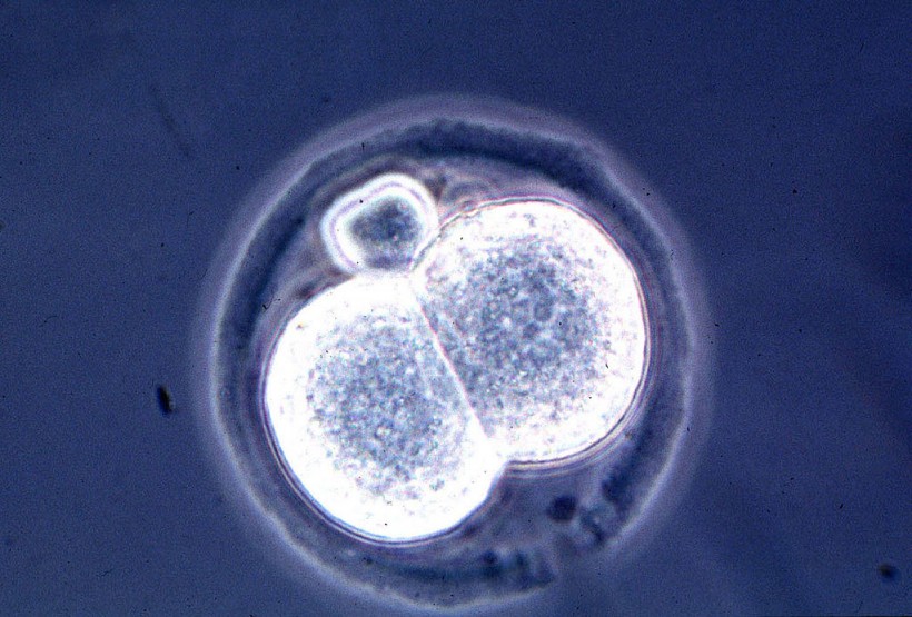 Microscopic View Of A Two Cell Mouse Embryo A Result Of A New And Relatively Simple Cloning Techniq