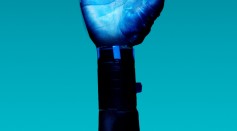 Prosthetic Arm on Blue Background