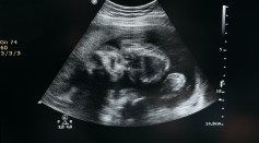  Unborn Babies Respond to Flavors From Foods Their Mothers Eat, Study Reveals
