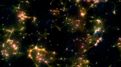 DishBrain's neural cells seen under a microscope.