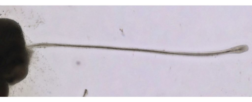A hair growing from one of the cultured follicle organoids.