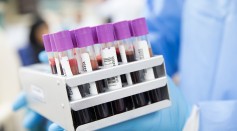  World-first Trial of Lab-grown Blood Could Revolutionize Treatment of Rare Disorders