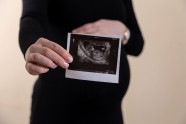 What An Early Embryo Looks Like Photos Of Tissue Shows What Happens 