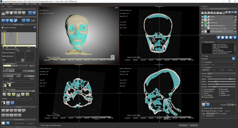 A screenshot of the computed tomography (CT) scans and 3D bioimaging software used to create a virtual model of King Tut’s skull.