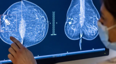 Google Teams with iCAD in designing technology detecting breast cancer through '3D Mammography.'