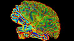 A new study used functional magnetic resonance imaging to show dramatic changes in the brain during pregnancy. Pregnancy increased gray matter loss and reshaped the default mode network, which is responsible for the mind wandering and a sense of identity.