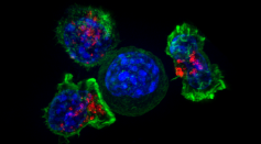 Cancer Metastasis: Fluid Surrounding the Cells Can Affect Its Migration, Disease Progression