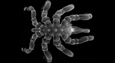 The adult sea spider (Pycnogonum litorale) in this microscope image made a full recovery after its back half was amputated, showing that arthropods can regrow more body parts than scientists realized.