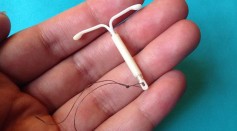 Baby Born Holding Mom’s IUD: What Can Cause This Birth Control Device to Fall Out?