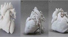 3D-Printed Heart Replica Functions Like The Real Thing; Could Help Doctors Determine The Best Implant For Patients