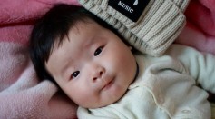 Fetus Developed Limbs, Bones, Fingernails While Growing Inside 1-Year-Old Twin Sister's Skull in China