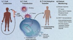 CAR-T Cell Therapy Effectively Removed the Tumor from a Brazilian Man, Providing a Cutting-Edge Treatment Against Cancer  