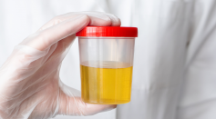 Understanding the Importance of Proper Urine Collection for Accurate Test Results