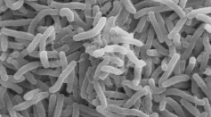 Cholera Bacteria Secrets Uncovered: Experts Discovered the Formation of Aggressive Biofilm on Immune Cells