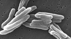 Tuberculosis Therapy Uses Targeted Drug Delivery with Nanoparticles, Providing a New Approach in Fighting Antibiotic Resistance