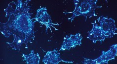 Breakthrough in Cancer Treatment Induces the Cells to Commit Suicide With Self-Produced Toxin