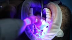 Do Oral Health Teeth Whitening Systems Work? Is It Safe for You?