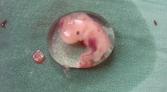 New Embryo Models Mimic Structures Found in Real Ones But Perfect Replica Is Not Desirable, Unlikely Possible