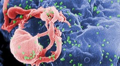 Geneva Patient Declared as the Sixth Person Free of HIV After Stem-Cell Therapy; How is He Different From the Previous Cases?