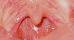 What Does the Uvula Do? Experts Propose Several Theories Regarding Its Function