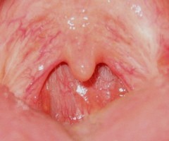 What Does the Uvula Do? Experts Propose Several Theories Regarding Its Function