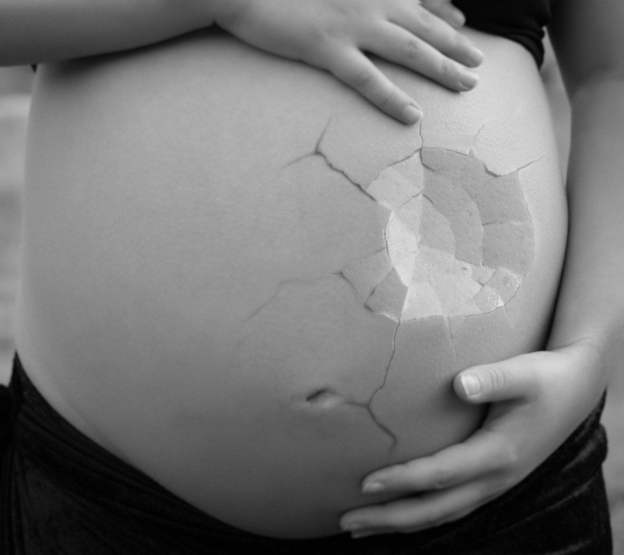 how-many-pregnancies-end-in-miscarriage-science-times