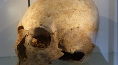 Japan's Ancient Indigenous Group Hirota Practiced Skull Deformation for Centuries, Study Reveals