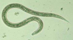 Hookworm Therapy Could Help People at Risk of Type 2 Diabetes From Developing Metabolic Disease [Study]