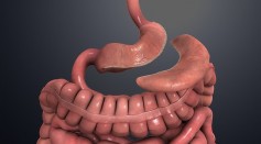 Gastric Sleeve 10 Years Later: What to Expect a Decade After Obesity Surgery?