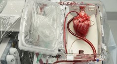 How Much Does a Heart Cost? Exploring the Worth, Procedure and Success Rate of Heart Transplant Surgery