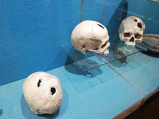 Bộ não, da của người thời đồ đồng 3.700 năm tuổi được tìm thấy trong cuộc khai quật ở Thổ Nhĩ Kỳ