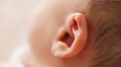 Hole in Ear: Everything You Need To Know About Preauricular Pit 