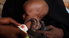 SOMALIA-DROUGHT-HEALTH