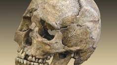 Roman-Era Skull Bearing Signs of Violent Trauma Unearthed in Spain, Shows Evidence of Cranial Tumor