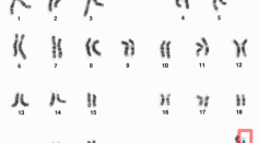 What Chromosomes Do Male Have? Y Chromosome Gender Explained