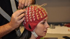 Surgery-Free Brain Stimulation Uses Implanted Electrodes as New Treatment Method for Dementia