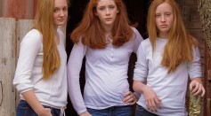 Do Redheads Experience Pain Differently? The Influence of Hair Color on Anesthesia Prescriptions