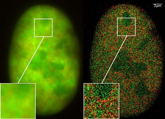 D Live-Cell Nanoscopy Enables Enhanced Imaging of Biological Structure, Revolutionizes Super-Resolution Microscopy