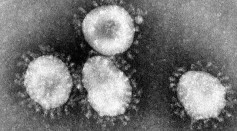 What Is GX_P2V? Mutant Coronavirus Strain Kills Humanized Mice Within 8 Days [Study]