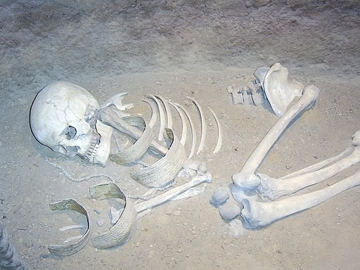 3,500-Year-Old Skeleton of a Woman With Rheumatoid Arthritis Discovered in Aswan, The Oldest Known Case in Ancient Egypt