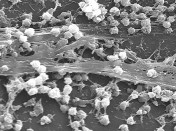 Sugar-Coated Gold Nanoparticles Rapidly Destroys Biofilms; Can They Replace Antibiotics in Eliminating Bacterial Infections?