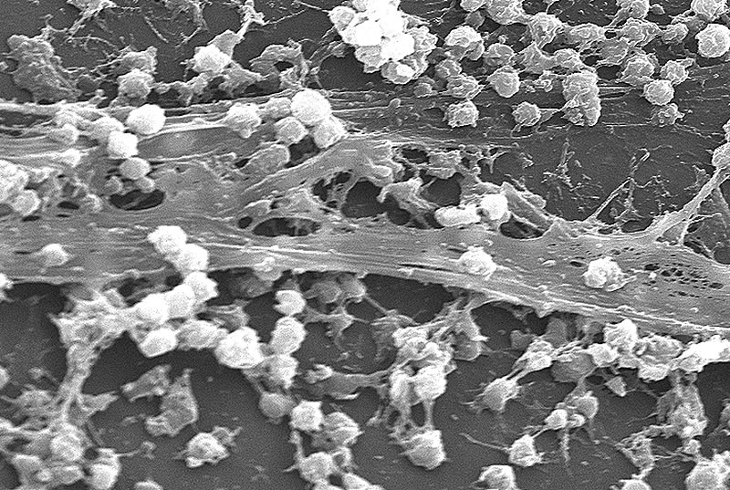 Sugar-Coated Gold Nanoparticles Rapidly Destroys Biofilms; Can They Replace Antibiotics in Eliminating Bacterial Infections?