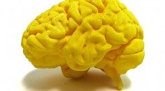 World’s First High-Resolution 3D-Printed Brain Developed as Model for Investigating Neurodegenerative Diseases