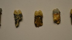 4,000-Year-Old Teeth Reveal Microbiome From Bronze Age; What Does Bacterial Genome Say About Evolution of Human Diet?