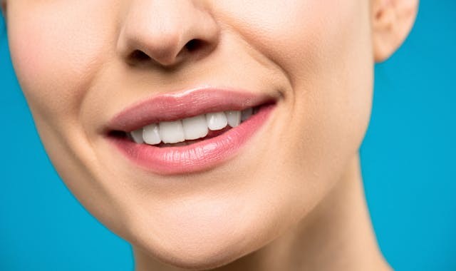 Why You Should Take Care of Your Natural Teeth? Here's What an Expert Says
