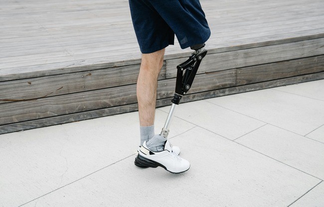  Brain-Controlled Bionic Leg Revolutionizes Mobility for Amputees