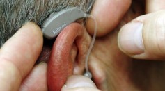 Hearing loss